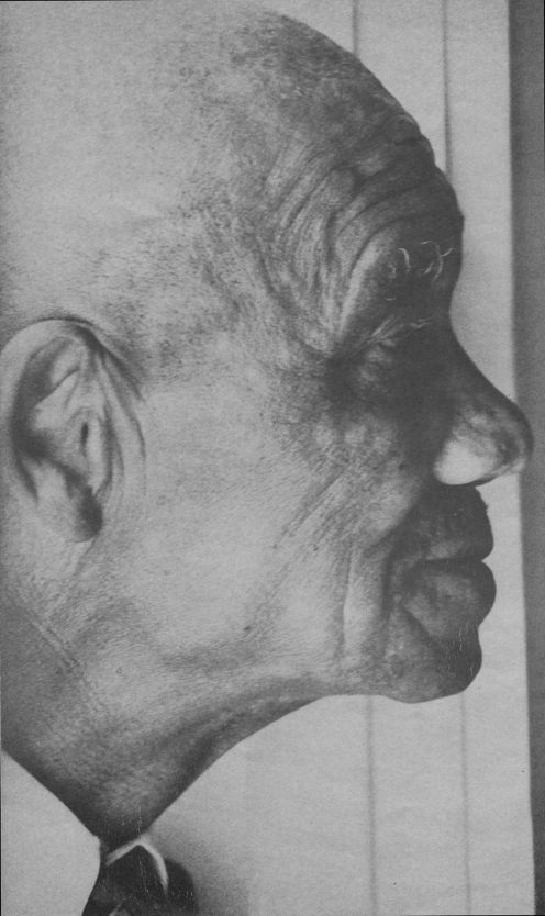 full-page: profile of bald man